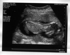 17 week scan